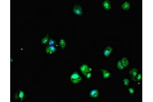 Immunofluorescent analysis of MCF-7 cells using ABIN7149610 at dilution of 1:100 and Alexa Fluor 488-congugated AffiniPure Goat Anti-Rabbit IgG(H+L) (DHRS12 antibody  (AA 1-271))
