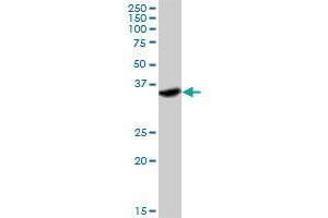 IFNGR2 MaxPab rabbit polyclonal antibody. (IFNGR2 antibody  (AA 1-337))