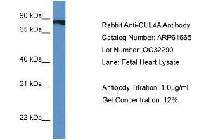 Western Blotting (WB) image for anti-Cullin 4A (CUL4A) (Middle Region) antibody (ABIN2788865) (Cullin 4A antibody  (Middle Region))