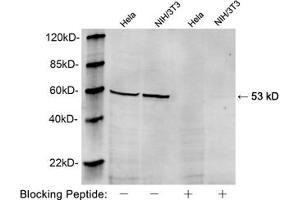 Western blot analysis of Hela and NIH/3T3 cell lysates using 1 µg/mL Rabbit Anti-Vimentin Polyclonal Antibody (ABIN398717) The signal was developed with IRDyeTM 800 Conjugated Goat Anti-Rabbit IgG (Vimentin antibody  (AA 70-120))