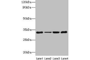 Western blot All lanes: PDCD1 antibody at 6 μg/mL Lane 1: 293T whole cell lysate Lane 2: Hela whole cell lysate Lane 3: K562 whole cell lysate Lane 4: Mouse stomach tissue Secondary Goat polyclonal to rabbit IgG at 1/10000 dilution Predicted band size: 32 kDa Observed band size: 32 kDa (PD-1 antibody  (AA 21-170))