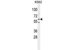 PRKAA2 (Thr172) Antibody western blot analysis in K562 cell line lysates (35µg/lane). (PRKAA2 antibody  (Middle Region, Thr172))