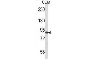 Western Blotting (WB) image for anti-Calpain 11 (CAPN11) antibody (ABIN2997590) (CAPN11 antibody)