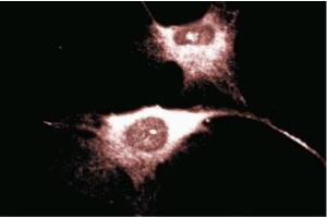 Immunofluorescence staining of Human Endothelial cells. (CD38 antibody  (AA 171-292))