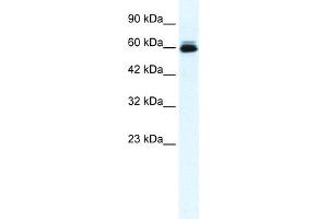 WB Suggested Anti-KCNH5 Antibody Titration:  0. (KCNH5 antibody  (N-Term))