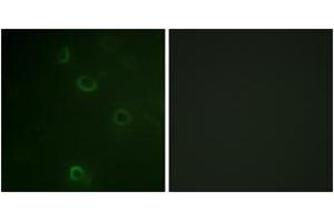 Immunofluorescence analysis of COS7 cells, using ATPase (Ab-16) Antibody. (ATPase antibody  (AA 5-54))