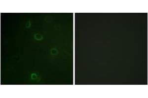 Immunofluorescence analysis of COS7 cells, using ATPase (Ab-16) Antibody. (ATPase antibody  (AA 5-54))