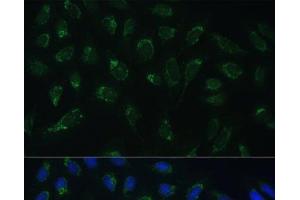 Immunofluorescence analysis of U-2 OS cells using HIGD1A Polyclonal Antibody at dilution of 1:100 (40x lens). (HIGD1A antibody)
