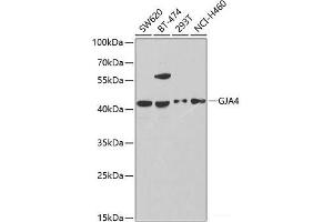 Western blot analysis of extracts of various cell lines using GJA4 Polyclonal Antibody at dilution of 1:1000. (GJA4 antibody)