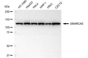 Western blotting analysis using SMARCA5 antibody (ABIN7800477).
