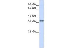 Image no. 1 for anti-Nanos Homolog 1 (NANOS1) (AA 108-157) antibody (ABIN6740717)