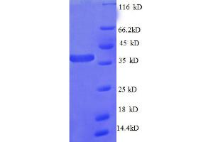 SDS-PAGE (SDS) image for Ribosomal Protein L27 (RPL27) (AA 2-85) protein (GST tag) (ABIN5712640)