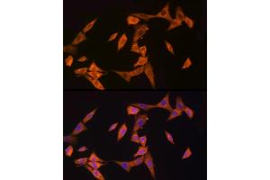 Immunofluorescence analysis of NIH/3T3 cells using NOD2 Rabbit pAb (ABIN7269065) at dilution of 1:150 (40x lens). (NOD2 antibody  (AA 611-910))