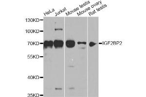 Western blot analysis of extracts of various cell lines, using IGF2BP2 antibody (ABIN6293018) at 1:1000 dilution. (IGF2BP2 antibody)