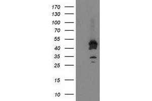 HEK293T cells were transfected with the pCMV6-ENTRY control (Left lane) or pCMV6-ENTRY ASCC1 (Right lane) cDNA for 48 hrs and lysed. (ASCC1 antibody)