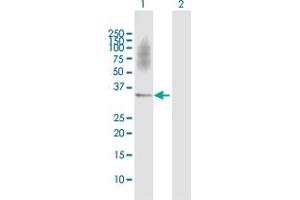 Western Blot analysis of SGCD expression in transfected 293T cell line by SGCD MaxPab polyclonal antibody. (SGCD antibody  (AA 1-290))