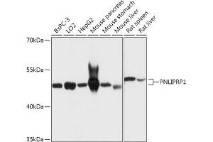Western blot analysis of extracts of various cell lines, using PNLIPRP1 antibody (ABIN7269167) at 1:1000 dilution. (PNLIPRP1 antibody  (AA 298-467))