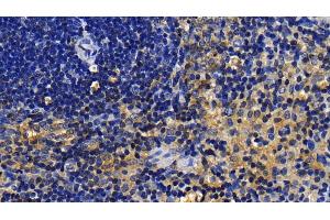 Detection of IRAK2 in Rat Spleen Tissue using Polyclonal Antibody to Interleukin 1 Receptor Associated Kinase 2 (IRAK2) (IRAK2 antibody  (AA 211-458))