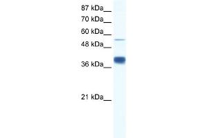 WB Suggested Anti-DKFZP781I1119 Antibody Titration:  0. (DKFZP781I1119 (N-Term) antibody)