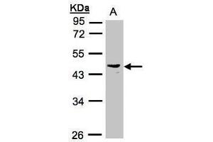 WB Image Sample(30 ug whole cell lysate) A:Raji , 10% SDS PAGE antibody diluted at 1:1000 (PSG6 antibody)
