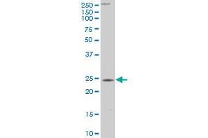 CTHRC1 polyclonal antibody (A01), Lot # 060428JCS1 Western Blot analysis of CTHRC1 expression in Hela S3 NE . (CTHRC1 antibody  (AA 32-141))