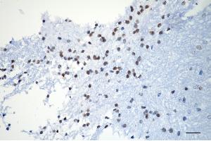 Immunohistochemistry was performed on paraffin-embedded mouse brain using XPD antibody (ABIN7798540), 1:200).