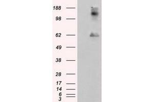 Image no. 7 for anti-Lipase, Endothelial (LIPG) antibody (ABIN1499165)