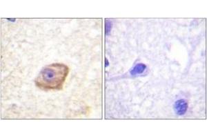 Immunohistochemistry analysis of paraffin-embedded human brain, using NMDAR2B (Phospho-Tyr1474) Antibody. (GRIN2B antibody  (pTyr1474))