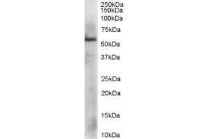 ABIN184885 staining (1µg/ml) of HepG2 lysate (RIPA buffer, 35µg total protein per lane).