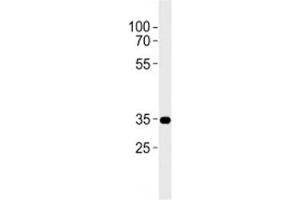 CB2 antibody western blot analysis in A431 lysate.
