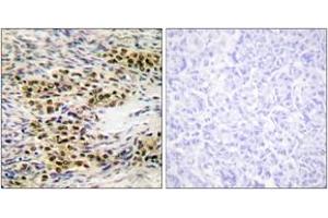 Immunohistochemistry analysis of paraffin-embedded human ovary tissue, using Akt (Ab-246) Antibody. (AKT1 antibody  (AA 212-261))