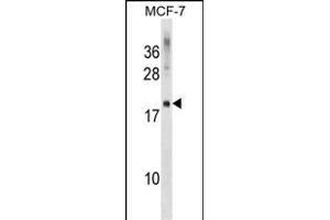 CMTM5 Antibody (Center) (ABIN1538533 and ABIN2849118) western blot analysis in MCF-7 cell line lysates (35 μg/lane). (CMTM5 antibody  (AA 62-88))