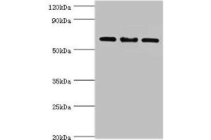 Western blot All lanes: IL22RA1 antibody at 10 μg/mL Lane 1: Mouse spleen tissue Lane 2: HepG2 whole cell lysate Lane 3: 293T whole cell lysate Secondary Goat polyclonal to rabbit IgG at 1/10000 dilution Predicted band size: 63 kDa Observed band size: 63 kDa (IL22 Receptor alpha 1 antibody  (AA 16-230))