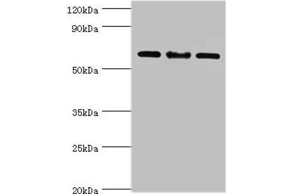 IL22 Receptor alpha 1 antibody  (AA 16-230)