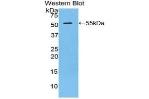 Detection of Recombinant GZMD, Mouse using Polyclonal Antibody to Granzyme D (GZMD) (Granzyme D antibody  (AA 33-245))