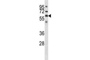 GPC3 antibody western blot analysis in NCI-H292 lysate. (Glypican 3 antibody  (AA 465-494))