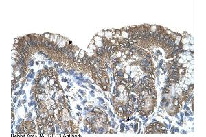 Immunohistochemistry (IHC) image for anti-Retinoic Acid Receptor Responder (Tazarotene Induced) 3 (RARRES3) (Middle Region) antibody (ABIN2782646) (RARRES3 antibody  (Middle Region))