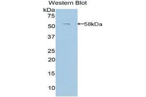 Western Blotting (WB) image for anti-Laminin, beta 3 (LAMB3) (AA 352-587) antibody (ABIN1859605) (Laminin beta 3 antibody  (AA 352-587))