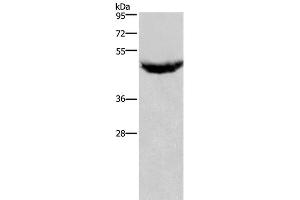 Western Blot analysis of Human serum solution using IL8RB Polyclonal Antibody at dilution of 1:125 (CXCR2 antibody)
