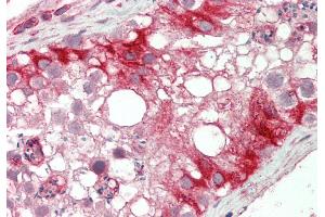 Rabbit Anti-KLHL25 antibody  Formalin Fixed Paraffin Embedded Tissue: Human Testis Primary antibody Concentration: 1:100 Secondary Antibody: Donkey anti-Rabbit-Cy3 Secondary Antibody Concentration: 1:200 Magnification: 20x Exposure Time: 0. (KLHL25 antibody  (N-Term))