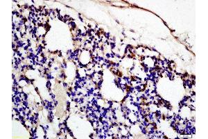 Formalin-fixed and paraffin embedded rat lung labeled with Rabbit Anti-Complement fragment 3c Polyclonal Antibody (ABIN873279) at 1:200 followed by conjugation to the secondary antibody and DAB staining (Complement C3c antibody  (AA 1051-1200))