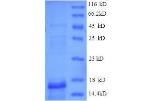 SDS-PAGE (SDS) image for Parvalbumin beta (PRVB) (AA 1-113), (full length) protein (His tag) (ABIN5711123) (PRVB Protein (AA 1-113, full length) (His tag))