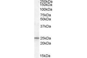 Western Blotting (WB) image for anti-Progesterone Receptor Membrane Component 1 (PGRMC1) antibody (ABIN5873921) (PGRMC1 antibody)