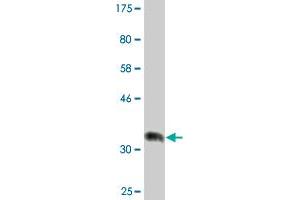 Western Blot detection against Immunogen (36. (RBBP9 antibody  (AA 87-185))