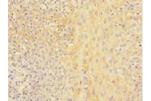 Immunohistochemistry of paraffin-embedded human tonsil tissue using ABIN7161344 at dilution of 1:100