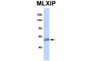 Western Blotting (WB) image for anti-MLX Interacting Protein (MLXIP) (Middle Region) antibody (ABIN2776519)