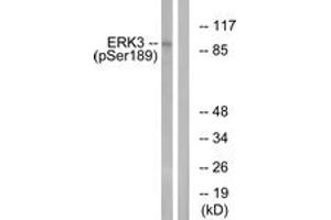 Western blot analysis of extracts from mouse brain, using ERK3 (Phospho-Ser189) Antibody. (MAPK6 antibody  (pSer189))