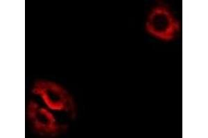 Immunofluorescent analysis of RPL14 staining in Hela cells. (RPL14 antibody)