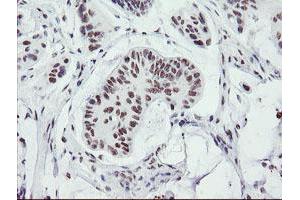 Image no. 1 for anti-SUMO1/sentrin/SMT3 Specific Peptidase 2 (SENP2) (AA 139-523) antibody (ABIN1490925) (SENP2 antibody  (AA 139-523))