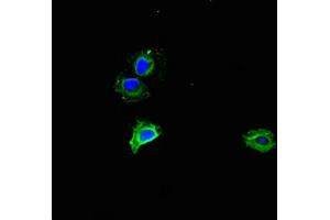 Immunofluorescent analysis of Hela cells using ABIN7142866 at dilution of 1:100 and Alexa Fluor 488-congugated AffiniPure Goat Anti-Rabbit IgG(H+L) (MMP2 antibody  (AA 445-660))